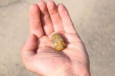 So verhindern Sie Gallensteine