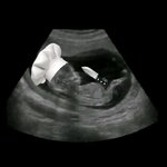 1742497656283.jpg 1742497656283.jpg