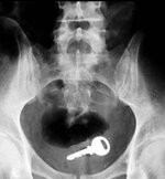 IMG_20221019_211017.jpg IMG_20221019_211017.jpg